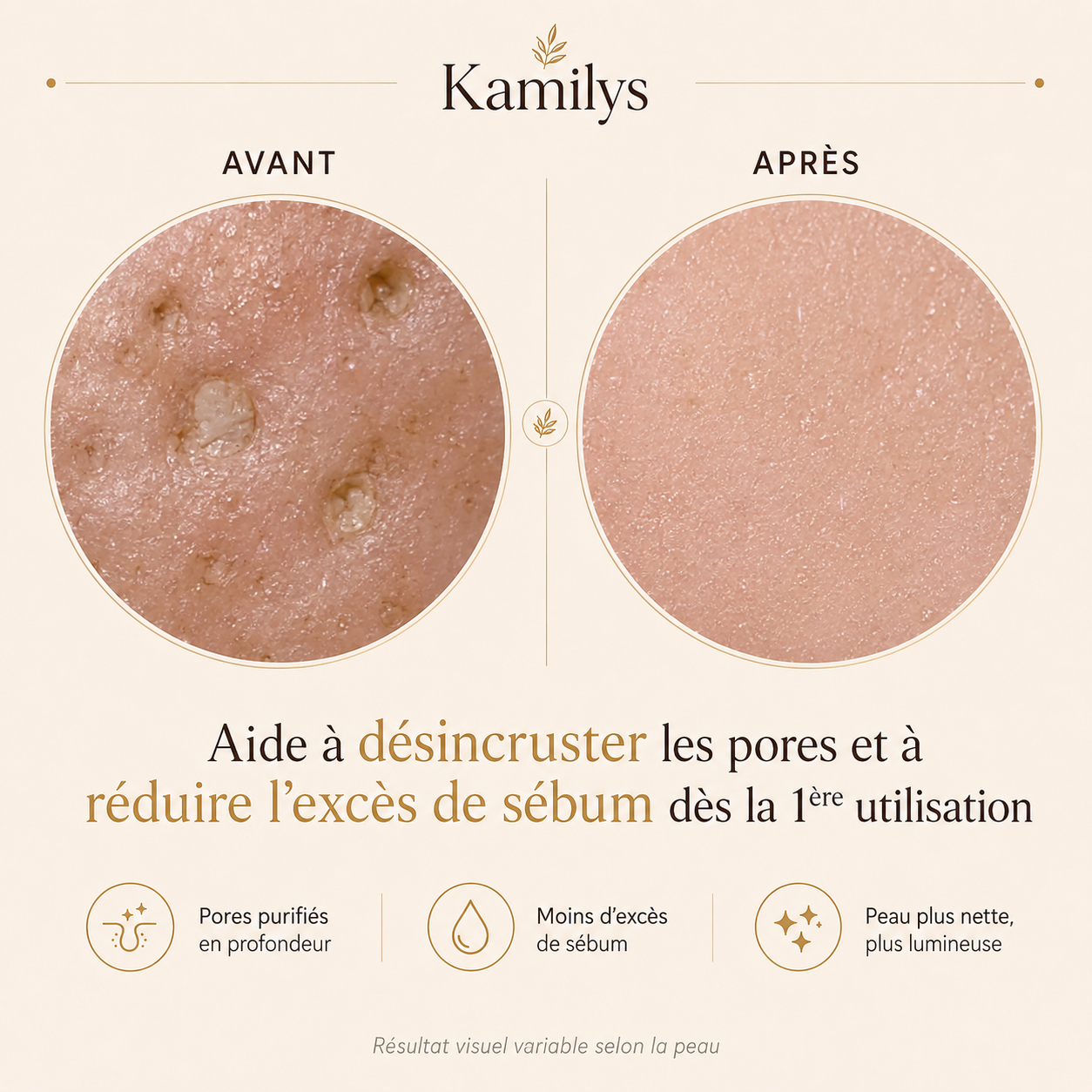 Kamilys® - Peel Shot