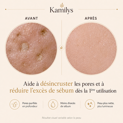 Kamilys® - Peel Shot